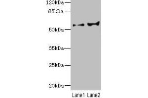 Western blot All lanes: CYP2C18 antibody at 5.