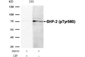 Western blot analysis of extracts from 293 cells, treated with starve or calf intestinal phosphatase (CIP), using SHP-2 (Phospho-Tyr580) Antibody.