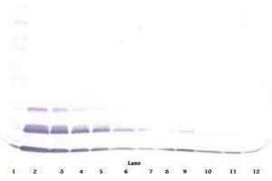 Image no. 2 for anti-Chemokine (C-C Motif) Ligand 15 (CCL15) antibody (Biotin) (ABIN465724) (CCL15 anticorps  (Biotin))