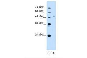 Image no. 2 for anti-Solute Carrier Family 29 (Nucleoside Transporters), Member 2 (SLC29A2) (AA 51-100) antibody (ABIN320827) (SLC29A2 anticorps  (AA 51-100))