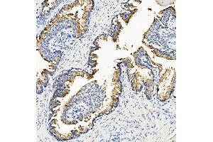 IHC analysis of Ribonuclease Inhibitor/RNH1 using anti-Ribonuclease Inhibitor/RNH1 antibody (ABIN7603117). (RNH1 anticorps  (N-Term))