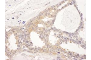 anti-Chaperonin Containing TCP1, Subunit 8 (Theta) (CCT8) (AA 398-448) antibody