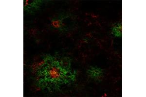 Indirect immunostaining of an PFA fixed section from a 5XFAD mouse with mouse anti-Abeta-pE3, clone 70D7 (dilution 1 : 100; red) and rabbit anti-Abeta (cat. (Abeta-pE3 (AA 3-7) anticorps)