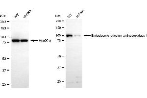 Western blotting analysis using endoplasmic reticulum aminopeptidase 1 antibody (ABIN7798442).