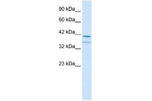 WB Suggested Anti-CEBPB Antibody Titration: 0. (CEBPB anticorps  (C-Term))