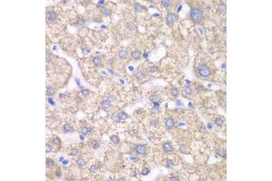 Immunohistochemistry of paraffin-embedded human liver injury using ACAT1 antibody.