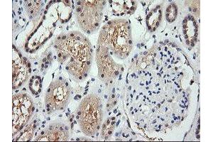 Image no. 1 for anti-Retinoic Acid Receptor Responder (Tazarotene Induced) 1 (RARRES1) antibody (ABIN1500600)