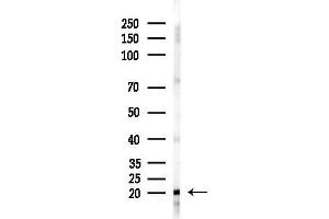 Western blot analysis of lysates from A2780 cells(starvation 24h treatment), using NDUFS4 Antibody at 1/1000 dilution.