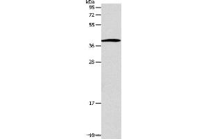Western blot analysis of Human lymphoma tissue, using SLC25A11 Polyclonal Antibody at dilution of 1:600 (SLC25A11 anticorps)