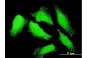 Immunofluorescence of monoclonal antibody to NXT1 on HeLa cell. (NXT1 anticorps  (AA 1-140))