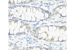 Immunohistochemistry of paraffin-embedded Human colon using NMT1 Polyclonal Antibody at dilution of 1:100 (40x lens). (NMT1 anticorps)