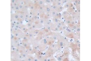 IHC-P analysis of Human Tissue, with DAB staining. (SERPINC1 anticorps  (AA 33-464))