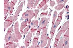 Human Heart (formalin-fixed, paraffin-embedded) stained with APAF1at 10 µg/ml followed by biotinylated goat anti-rabbit IgG secondary antibody, alkaline phosphatase-streptavidin and chromogen. (APAF1 anticorps  (C-Term))