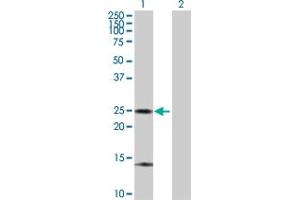 Western Blot analysis of ARHGDIA expression in transfected 293T cell line by ARHGDIA MaxPab polyclonal antibody. (ARHGDIA anticorps  (AA 1-204))