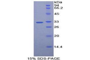 SDS-PAGE analysis of Human MAEA Protein. (MAEA Protéine)