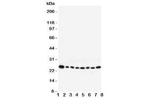 Western blot testing of Rab8 antibody and Lane 1:  rat brain (RAB8A anticorps  (C-Term))