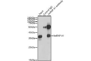 Immunoprecipitation analysis of 300 μg extracts of HeLa cells using 3 μg hnRNP  antibody (1564).