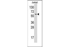 Western blot analysis of anti-YARS Pab in Jurkat cell line lysates (35ug/lane). (YARS anticorps  (N-Term))