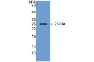 Detection of Recombinant PGA, Human using Monoclonal Antibody to Pepsinogen A (PGA)