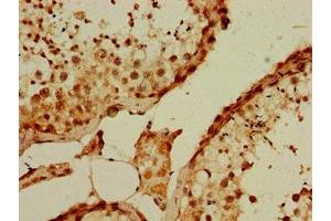 Immunohistochemistry of paraffin-embedded human testis tissue using ABIN7163840 at dilution of 1:100 (PQBP1 anticorps  (AA 2-265))