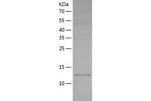 Interleukin 1 Family, Member 6 (IL1F6) (AA 1-158) protein (His tag)