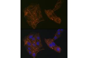 Immunofluorescence analysis of U-2 OS cells using α-Actinin-4 Rabbit mAb (ABIN7265399) at dilution of 1:100 (40x lens).