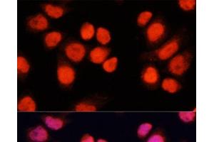 Immunofluorescence analysis of Hela cells using CHAMP1 Polyclonal Antibody at dilution of 1:100 (40x lens).
