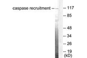 Western blot analysis of extracts from HeLa cells, using CARD6 Antibody.