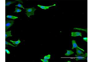 Immunofluorescence of monoclonal antibody to TUBA1B on HeLa cell. (TUBA1B anticorps  (AA 1-451))
