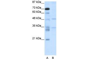 WB Suggested Anti-HTLF Antibody Titration:  2. (FOXN2 anticorps  (C-Term))