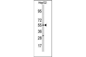 Image no. 1 for anti-Cytochrome P450, Family 11, Subfamily A, Polypeptide 1 (CYP11A1) (N-Term) antibody (ABIN360271) (CYP11A1 anticorps  (N-Term))