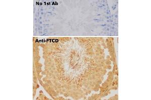 Immunohistochemistry (IHC) image for anti-Formiminotransferase Cyclodeaminase (FTCD) (N-Term) antibody (ABIN6254252)