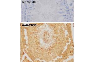 Immunohistochemistry (IHC) image for anti-Formiminotransferase Cyclodeaminase (FTCD) (N-Term) antibody (ABIN6254252) (FTCD anticorps  (N-Term))