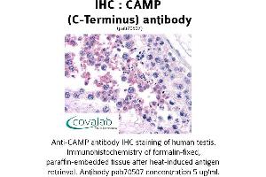 Image no. 1 for anti-Cathelicidin Antimicrobial Peptide (CAMP) (C-Term) antibody (ABIN1732585) (Cathelicidin anticorps  (C-Term))
