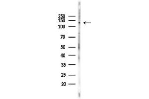 anti-DNA Repair Protein Complementing XP-G Cells (ERCC5) (N-Term) antibody