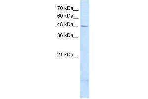 WB Suggested Anti-PSD3 Antibody Titration:  2. (PSD3 anticorps  (Middle Region))