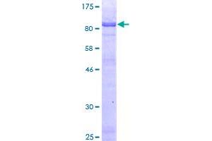 Image no. 1 for H2.0-Like Homeobox (HLX) (AA 1-488) protein (GST tag) (ABIN1306777)