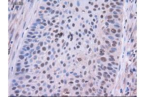 Image no. 6 for anti-Epithelial Cell Adhesion Molecule (EPCAM) (AA 24-265) antibody (ABIN1491256) (EpCAM anticorps  (AA 24-265))