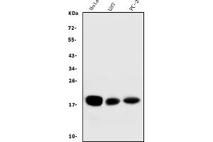 Western blot analysis of CD59 using anti-CD59 antibody (ABIN7600941).