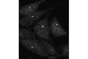Immunofluorescence staining of Autophagy UVRAG antibody (ABIN388586 and ABIN2849984) on Methanol-fixed HeLa cells. (UVRAG anticorps  (C-Term))