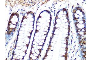Immunohistochemistry of paraffin-embedded human colon using PP1 beta Rabbit mAb (ABIN1679819, ABIN3018859, ABIN3018860 and ABIN7101675) at dilution of 1:100 (40x lens). (PPP1CB anticorps)