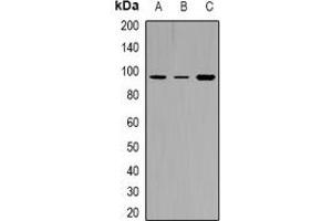 Western blot analysis of TYRO3/MERTK (pY749/681) expression in HEK293T (A), H1688 (B), NIH3T3 EGF-treated (C) whole cell lysates. (MerTK/Tyro3 anticorps  (C-Term, pTyr681, pTyr749))