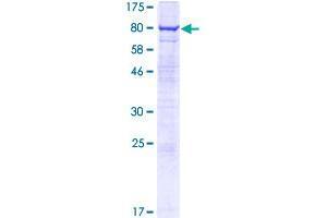 Image no. 1 for AVL9 Homolog (AVL9) (AA 1-463) protein (GST tag) (ABIN1346230) (AVL9 Protein (AA 1-463) (GST tag))