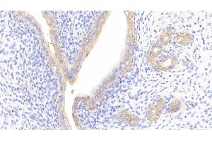 Detection of CTTN in Rat Uterus Tissue using Polyclonal Antibody to Cortactin (CTTN) (Cortactin anticorps  (AA 1-509))