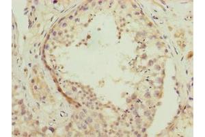 Immunohistochemistry of paraffin-embedded human testis tissue using ABIN7166731 at dilution of 1:100 (NSUN7 anticorps  (AA 1-300))