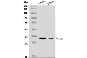 anti-Cerebellar Degeneration-Related Protein 1, 34kDa (CDR1) (AA 1-152) antibody
