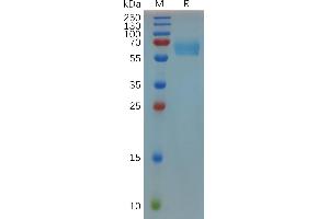 Mouse CD27 Protein, hFc Tag on SDS-PAGE under reducing condition.