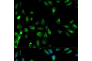 Immunofluorescence analysis of HeLa cells using RASSF1 Polyclonal Antibody