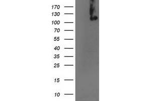 Western Blotting (WB) image for anti-Excision Repair Cross-Complementing Rodent Repair Deficiency, Complementation Group 4 (ERCC4) antibody (ABIN1498073) (ERCC4 anticorps)