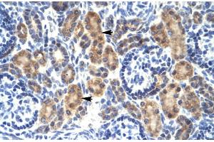 Rabbit Anti-MYCBP Antibody Catalog Number: ARP31860 Paraffin Embedded Tissue: Human Kidney Cellular Data: Epithelial cells of renal tubule Antibody Concentration: 4. (MYCBP anticorps  (Middle Region))